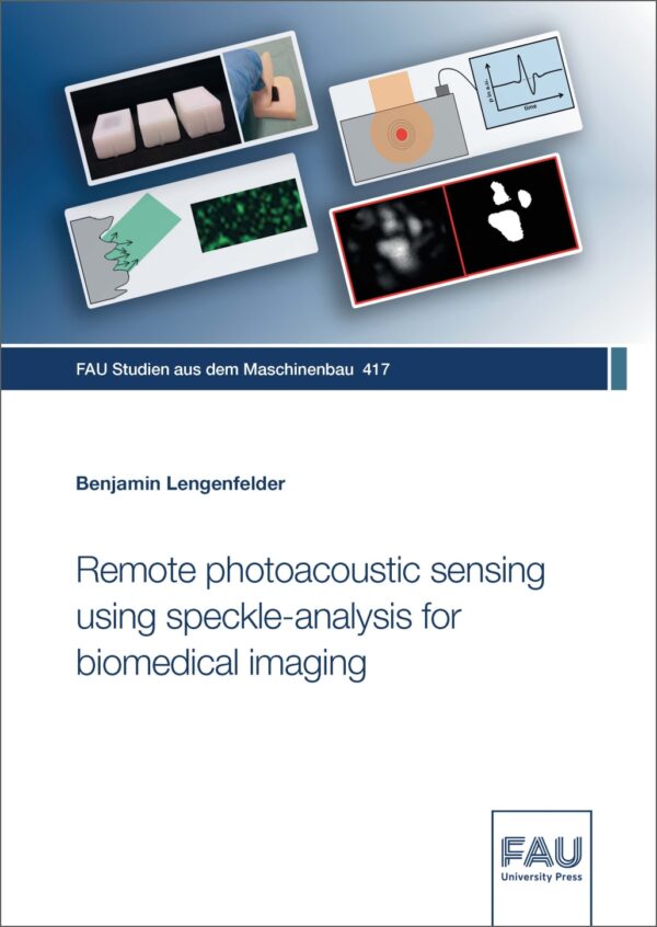 Titelbild Remote photoacoustic sensing using speckle-analysis for biomedical imaging